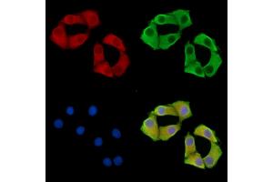 ABIN7095844 and ABIN7099906 staining Hela cells by IF/ICC. (B4GALNT3 Antikörper)