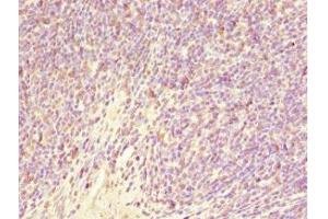 Immunohistochemistry of paraffin-embedded human thymus tissue using ABIN7153505 at dilution of 1:100 (GABRR1 Antikörper  (AA 365-465))