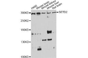 Western blot analysis of extracts of various cell lines, using SETD2 antibody (ABIN1874744) at 1:1000 dilution. (SETD2 Antikörper)
