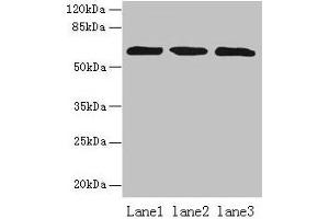Western blot All lanes: ZNF554 antibody at 5 μg/mL Lane 1: K562 whole cell lysate Lane 2: U937 whole cell lysate Lane 3: A549 whole cell lysate Secondary Goat polyclonal to rabbit IgG at 1/10000 dilution Predicted band size: 61 kDa Observed band size: 61 kDa (ZNF554 Antikörper  (AA 239-538))