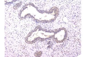 IHC analysis of PPID using anti-PPID antibody (ABIN6719438).