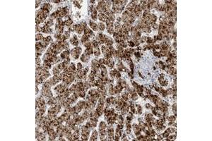 Immunohistochemical staining of human liver with AGXT polyclonal antibody  shows strong cytoplasmic positivity in granular pattern in hepatocytes at 1:1000-1:2500 dilution. (AGXT Antikörper)