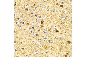 Immunohistochemistry of paraffin-embedded Rat brain using BIN1 antibody at dilution of 1:100 (x40 lens). (BIN1 Antikörper)