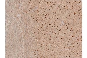 Immunohistochemistry (IHC) image for anti-LIM Domain Kinase 1 (LIMK1) (pThr508) antibody (ABIN6255701)
