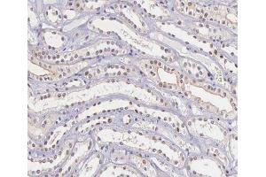 ABIN6266662 at 1/100 staining human kidney tissue sections by IHC-P. (TIMP4 Antikörper  (C-Term))