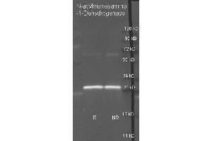 Goat anti N-acylmanosamino-1-Dehydrogenase antibody ( was used to detect purified N-acylmanosamino-1-Dehydrogenase under reducing (R) and non-reducing (NR) conditions. (WECC Antikörper  (Biotin))
