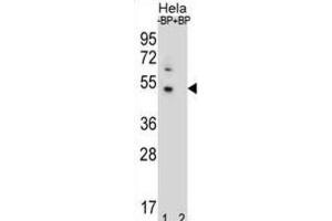 Western Blotting (WB) image for anti-DnaJ (Hsp40) Homolog, Subfamily B, Member 6 (DNAJB6) antibody (ABIN2996781) (DNAJB6 Antikörper)