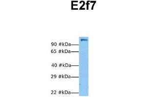 Host:  Rabbit  Target Name:  E2f7  Sample Tissue:  Human NIH-3T3  Antibody Dilution:  1. (E2F7 Antikörper  (N-Term))