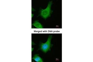 ICC/IF Image Immunofluorescence analysis of paraformaldehyde-fixed HeLa, using Calcium Sensing Receptor, antibody at 1:200 dilution. (CASR Antikörper)