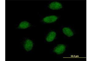 Immunofluorescence of purified MaxPab antibody to SNAI1 on HeLa cell.