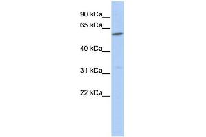 CEACAM16 antibody used at 1 ug/ml to detect target protein.