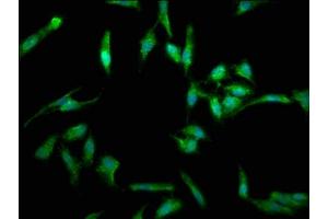Immunofluorescence staining of Hela cells with ABIN7173813 at 1:330, counter-stained with DAPI. (FASL Antikörper  (AA 103-281))