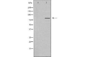 Western blot analysis of extracts from K562 cells, using MLH1 antibody. (MLH1 Antikörper  (Internal Region))