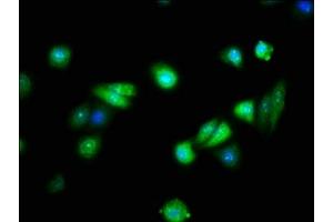 Immunofluorescence staining of HepG2 cells with ABIN7152575 at 1:133, counter-stained with DAPI. (FAIM Antikörper  (AA 1-179))
