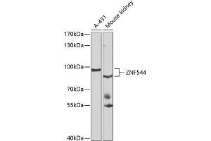 Western blot analysis of extracts of various cell lines, using ZNF544 antibody (ABIN6133073, ABIN6150511, ABIN6150513 and ABIN6223223) at 1:1000 dilution. (ZNF544 Antikörper  (AA 1-230))