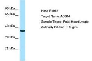 Image no. 1 for anti-Ankyrin Repeat and SOCS Box Containing 14 (ASB14) (AA 45-94) antibody (ABIN6750157) (ASB14 Antikörper  (AA 45-94))