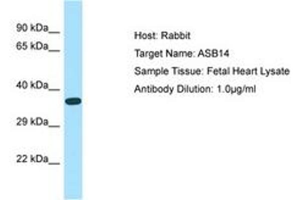 ASB14 Antikörper  (AA 45-94)