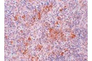Immunohistochemical staining of mouse kidney tissue with 2. (Angiotensin II Type-1 Receptor Antikörper  (Internal Region))