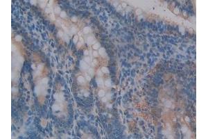 Immunohistochemistry (IHC) image for anti-Matrix Metallopeptidase 3 (Stromelysin 1, Progelatinase) (MMP3) (AA 98-475) antibody (ABIN7442972)