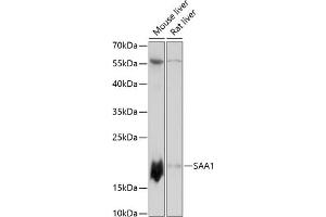 Western blot analysis of extracts of various cell lines, using S antibody (ABIN7270255) at 1:3000 dilution. (SAA1 Antikörper  (AA 1-100))