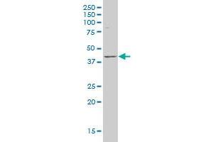 LANCL1 polyclonal antibody (A01), Lot # 050914JC01. (LANCL1 Antikörper  (AA 1-58))