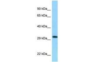 Image no. 1 for anti-Rh Blood Group, D Antigen (RHD) (AA 165-214) antibody (ABIN6748103) (RHD Antikörper  (AA 165-214))