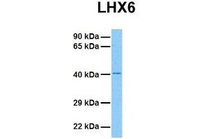 Western Blotting (WB) image for anti-LIM Homeobox 6 (LHX6) (C-Term) antibody (ABIN2779717)