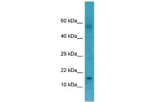 WB Suggested Anti-CTAG1B Antibody Titration: 1. (CTAG1B Antikörper  (Middle Region))