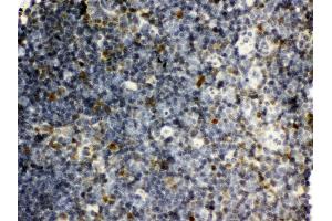 anti-Small Nuclear Ribonucleoprotein Polypeptide N (SNRPN) (AA 11-39), (N-Term) antibody