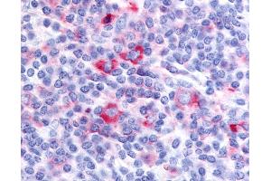 Anti-GPRC5D antibody IHC of human tonsil.