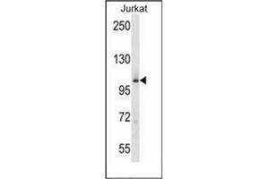 Western blot analysis of MAP4K2 Antibody (Center) in Jurkat cell line lysates (35ug/lane). (MAP4K2 Antikörper  (Middle Region))