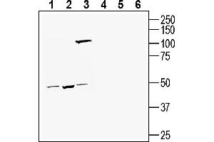 Western blot analysis of human SH-SY5Y neuroblastoma cell line lysate (lanes 1 and 4), human  monocytic leukemia cell line lysate (lanes 2 and 5) and human LNCaP prostate adenocarcinoma cell line lysate (lanes 3 and 6):1-3. (TMEM175 Antikörper  (AA 278-291))