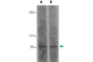 Western blot analysis of FRMPD2 in rat kidney tissue lysate with FRMPD2 polyclonal antibody  at (A) 1 and (B) 2 ug/mL . (FRMPD2 Antikörper  (N-Term))