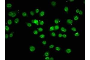 Immunofluorescence staining of Hela cells (treated with 30mM sodium butyrate for 4h) with ABIN7139194 at 1:7. (HIST1H1C Antikörper  (acLys74))