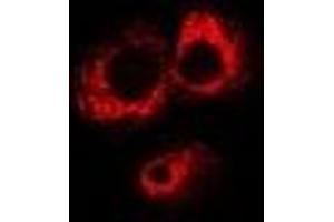 Immunofluorescent analysis of ABO staining in MCF7 cells. (ABO Antikörper)