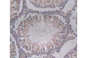 DAB staining on IHC-P; Samples: Rat Testis Tissue. (SERPINA6 Antikörper  (AA 173-344))