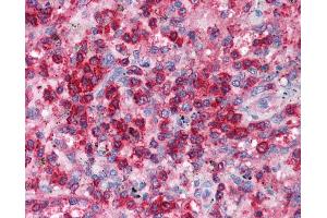 Human Heart; EAP30 antibody - N-terminal region in Human Heart cells using Immunohistochemistry (SNF8 Antikörper  (N-Term))