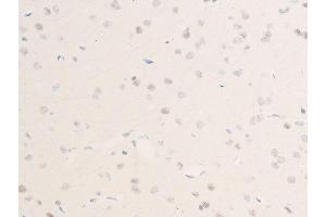 ABIN6256255 and ABIN6267223 at 1/100 staining rat brain tissue sections by IHC-P. (CHEK1 Antikörper  (pSer301))