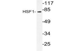 Western blot (WB) analyzes of HSF1 antibody in extracts from RAW264. (HSF1 Antikörper)