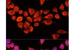 Immunofluorescence analysis of 293T cells using AADAC Polyclonal Antibody at dilution of 1:100 (40x lens). (AADAC Antikörper)