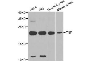 Western blot analysis of extracts of various cell lines, using TNFα antibody. (TNF alpha Antikörper  (AA 1-233))