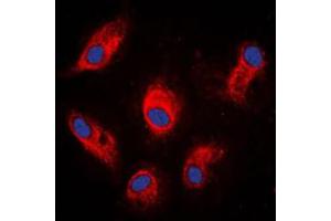 Immunofluorescent analysis of Involucrin staining in MCF7 cells. (Involucrin Antikörper  (C-Term))