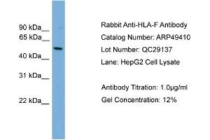 WB Suggested Anti-HLA-F  Antibody Titration: 0. (HLA-F Antikörper  (N-Term))
