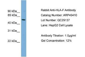 WB Suggested Anti-HLA-F  Antibody Titration: 0. (HLA-F Antikörper  (N-Term))