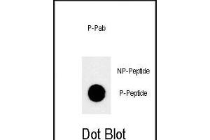 Dot blot analysis of anti-Phospho-JMJD1B-p Phospho-specific Pab (ABIN650878 and ABIN2839821) on nitrocellulose membrane. (KDM3B Antikörper  (pSer291))