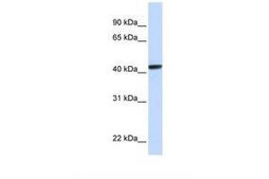 Image no. 1 for anti-Ceroid-Lipofuscinosis, Neuronal 8 (Epilepsy, Progressive with Mental Retardation) (CLN8) (N-Term) antibody (ABIN6738555)