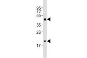 Western blot testing of Shh antibody at 1:2000 dilution + mouse stomach lysate (Sonic Hedgehog Antikörper  (N-Term))