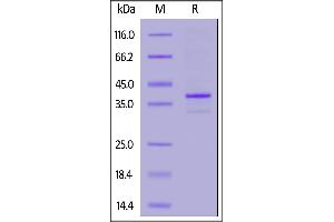 SDS-PAGE (SDS) image for Membrane-Spanning 4-Domains, Subfamily A, Member 1 (MS4A1) (AA 1-297) (Active) protein (His tag) (ABIN6809865)