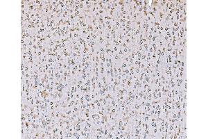 IHC analysis of SND1 using anti-SND1 antibody (ABIN7600525). (SND1 Antikörper  (AA 20-204))