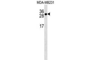 TNFRSF17 Antibody (Center) western blot analysis in MDA-MB231 cell line lysates (35 µg/lane). (BCMA Antikörper  (Middle Region))
